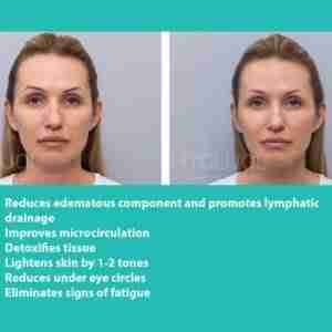 HYALUAL Xela Rederm 1.1