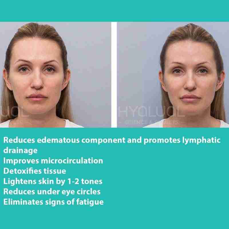 HYALUAL Xela Rederm 1.1