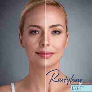 Restylane® Lyft with Lidocaine