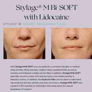 Stylage M with Lidocaine Bisoft Stylage M with Lidocaine Bisoft