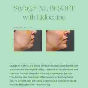 Stylage XL Lido Bisoft Stylage XL Lido Bisoft