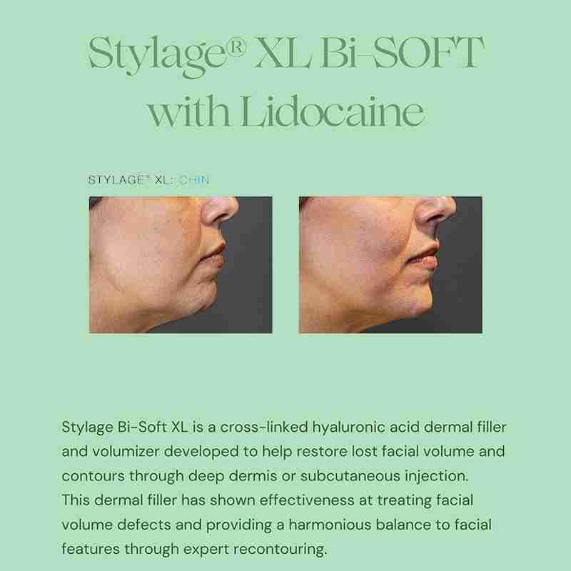 Stylage XL Lido Bisoft Stylage XL Lido Bisoft
