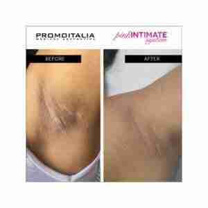 Promoitalia Pink Intimate Peeling