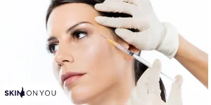 Face Filler Brand - Skin on You Best filler brand for face